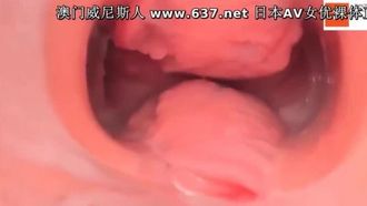 貴重な資料: 女性の膣内を映す高精細内視鏡が美容・整体病院から流出