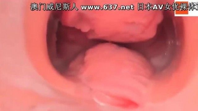 희귀자료: 미용보디빌딩 병원에서 유출된 여성의 질 내부를 보여주는 고화질 내시경